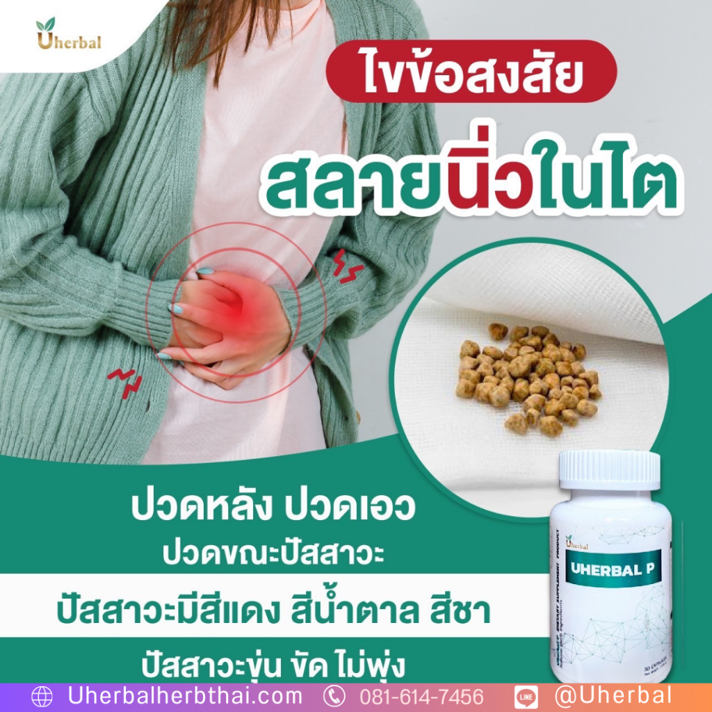 ยา สลาย นิ่ว" มีจริงไหม? 