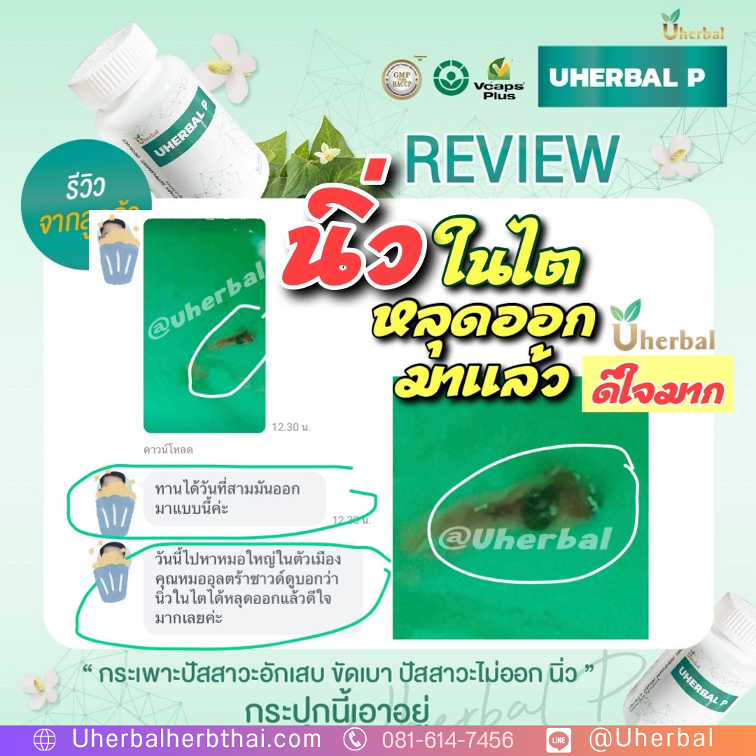  "ยา สลาย นิ่ว ราคา" ควรเลือกซื้อแบบไหนถึงจะคุ้มค่าที่สุด?