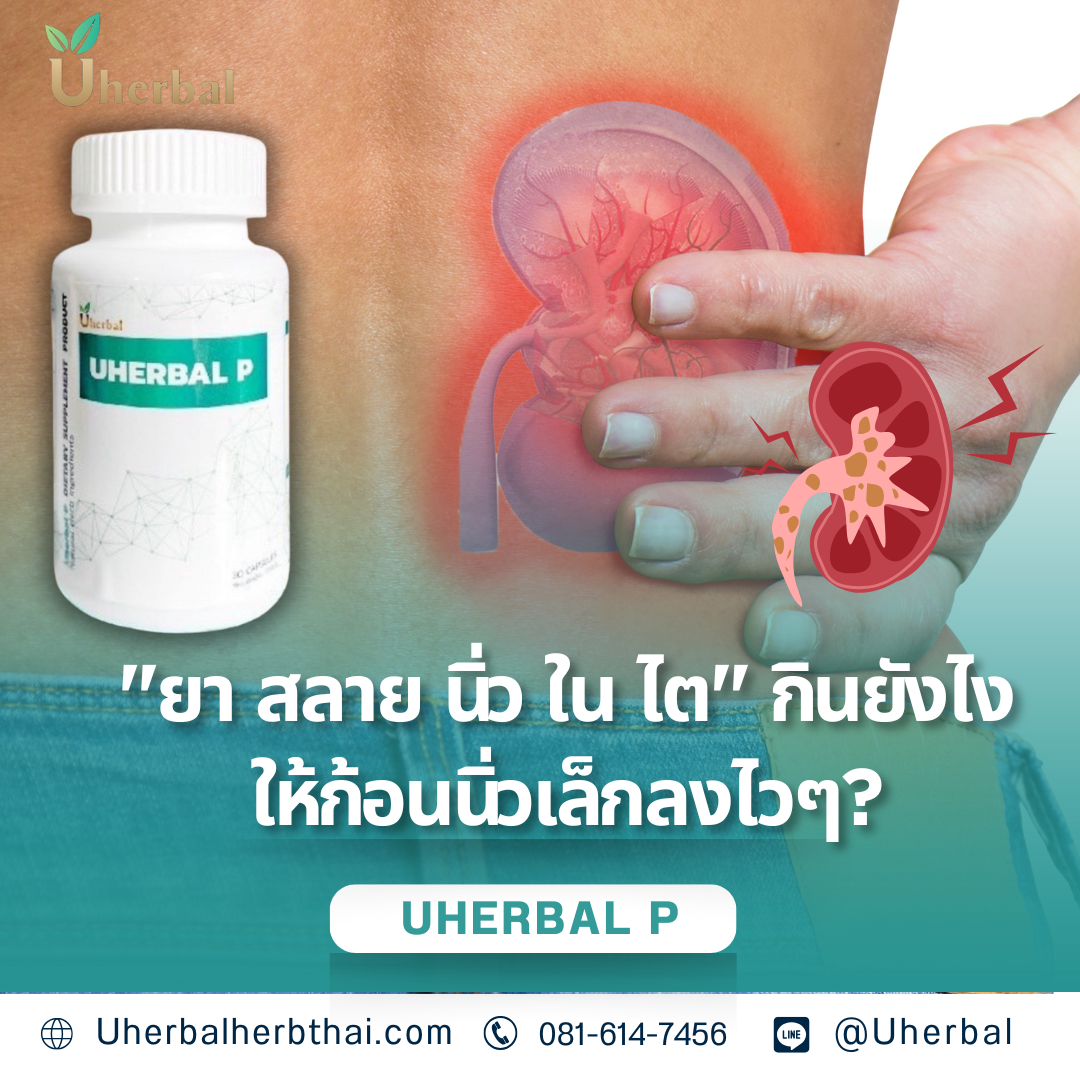 "ยา สลาย นิ่ว ใน ไต" กินยังไง ให้ก้อนนิ่วเล็กลงไวๆ?