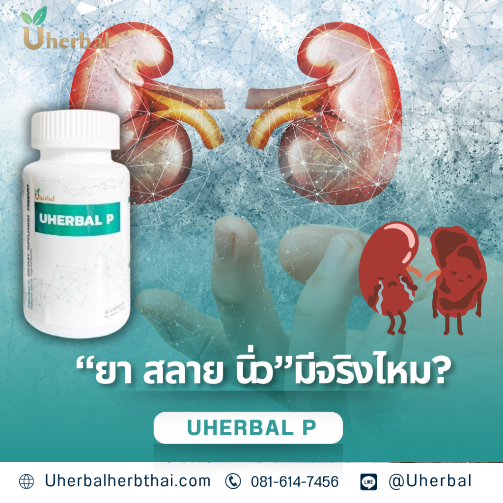 ยา สลาย นิ่ว" มีจริงไหม?