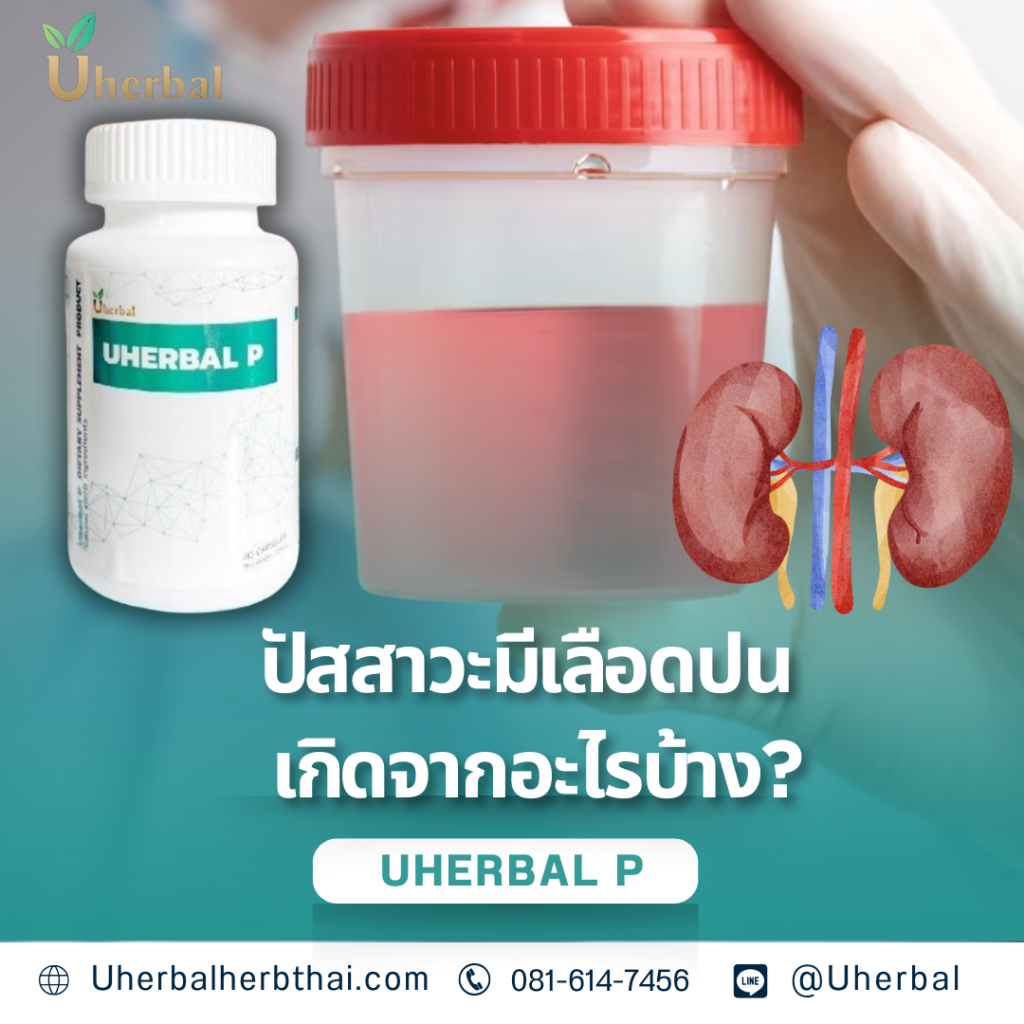 ปัสสาวะมีเลือดปน เกิดจากอะไรบ้าง?