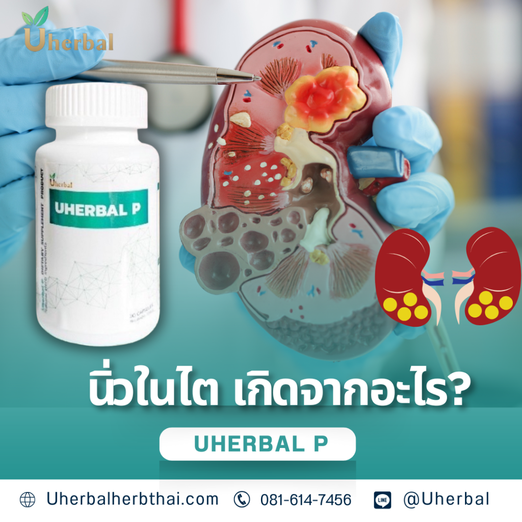 นิ่วในไต เกิดจากอะไร?