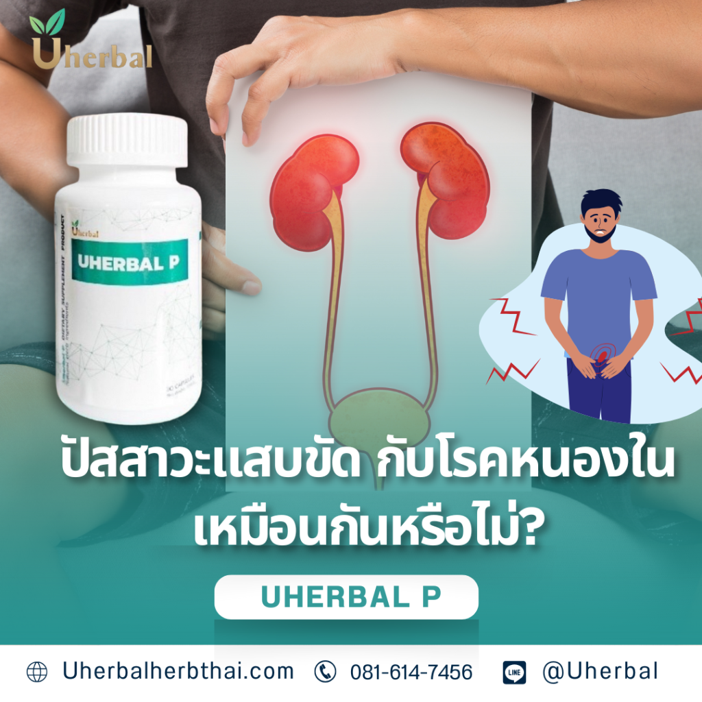 ปัสสาวะแสบขัด กับโรคหนองในเหมือนกันหรือไม่?