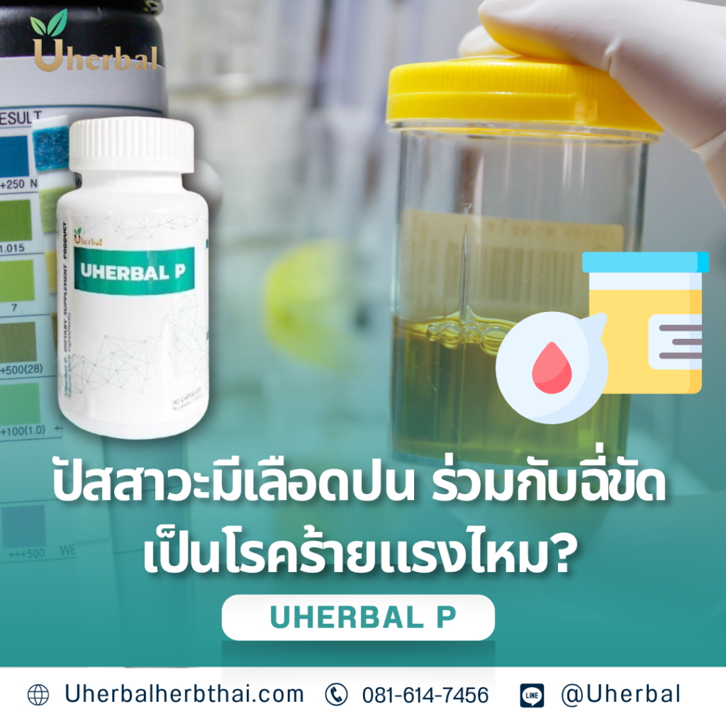 ปัสสาวะมีเลือดปน ร่วมกับฉี่ขัด เป็นโรคร้ายแรงไหม?