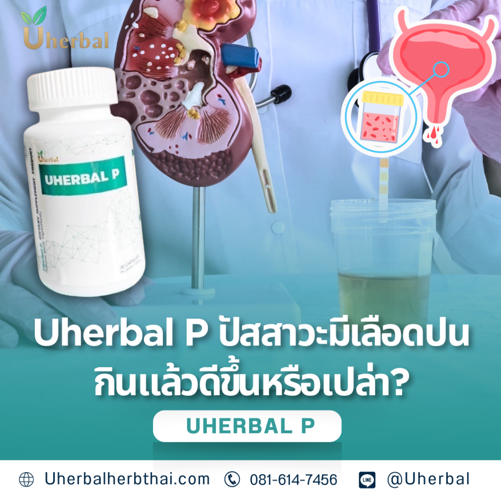 Uherbal P ปัสสาวะมีเลือดปน กินแล้วดีขึ้นหรือเปล่า?