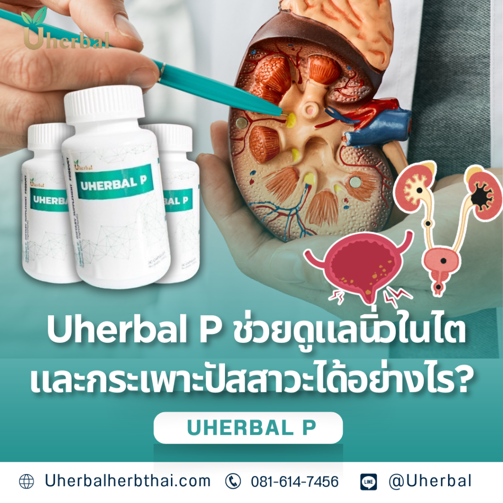 Uherbal P ช่วยดูแลนิ่วในไตและกระเพาะปัสสาวะได้อย่างไร?