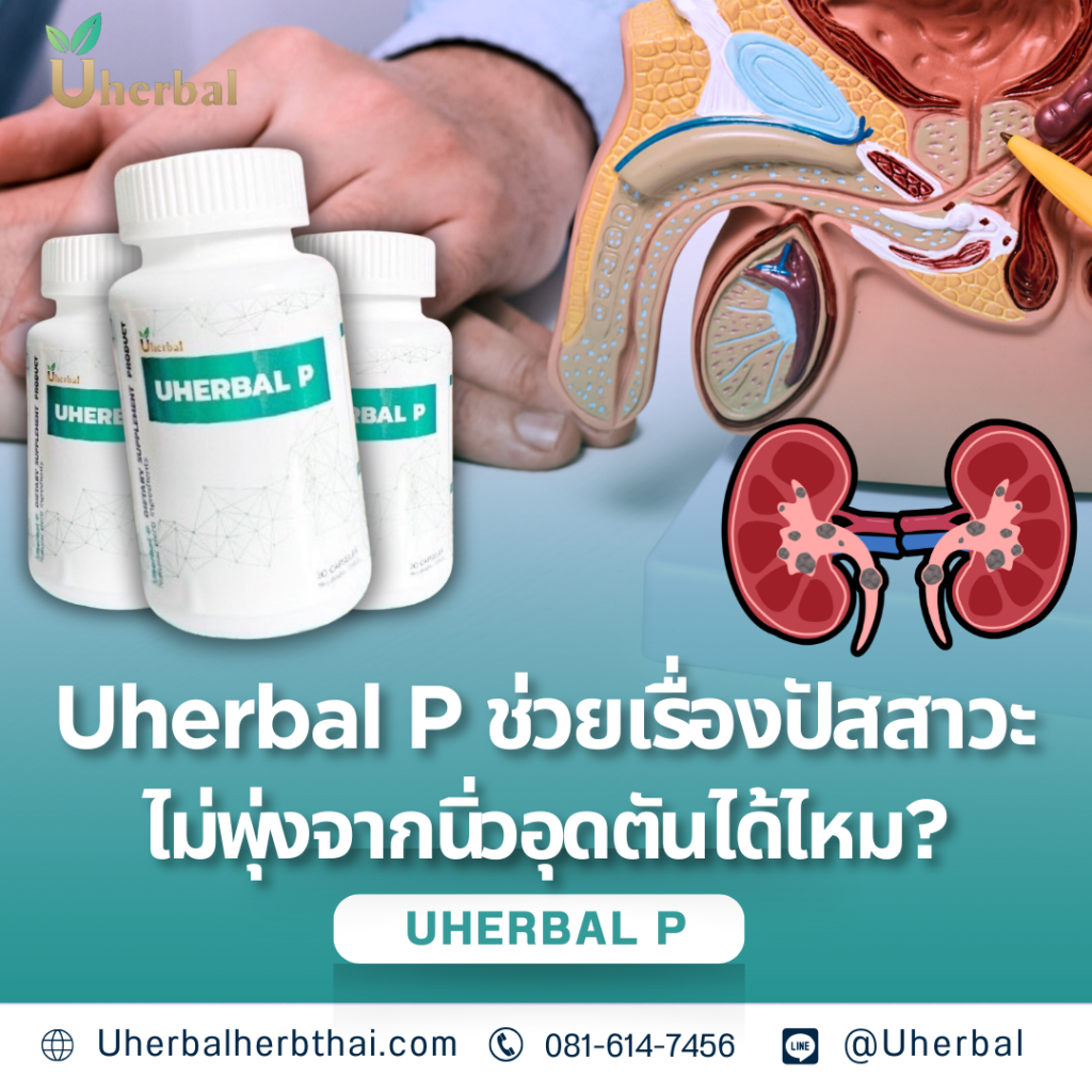 Uherbal P ช่วยเรื่องปัสสาวะไม่พุ่งจากนิ่วอุดตันได้ไหม?