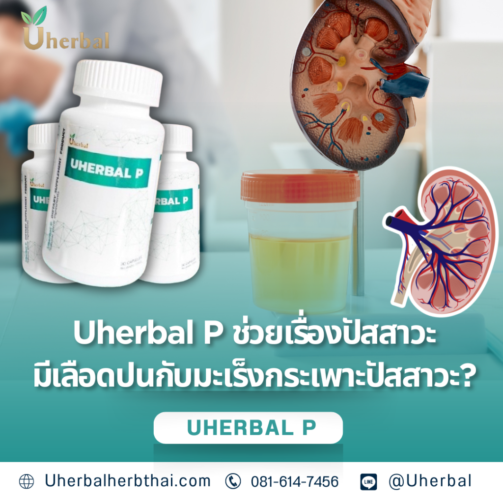Uherbal P ช่วยเรื่องปัสสาวะมีเลือดปนกับมะเร็งกระเพาะปัสสาวะ?