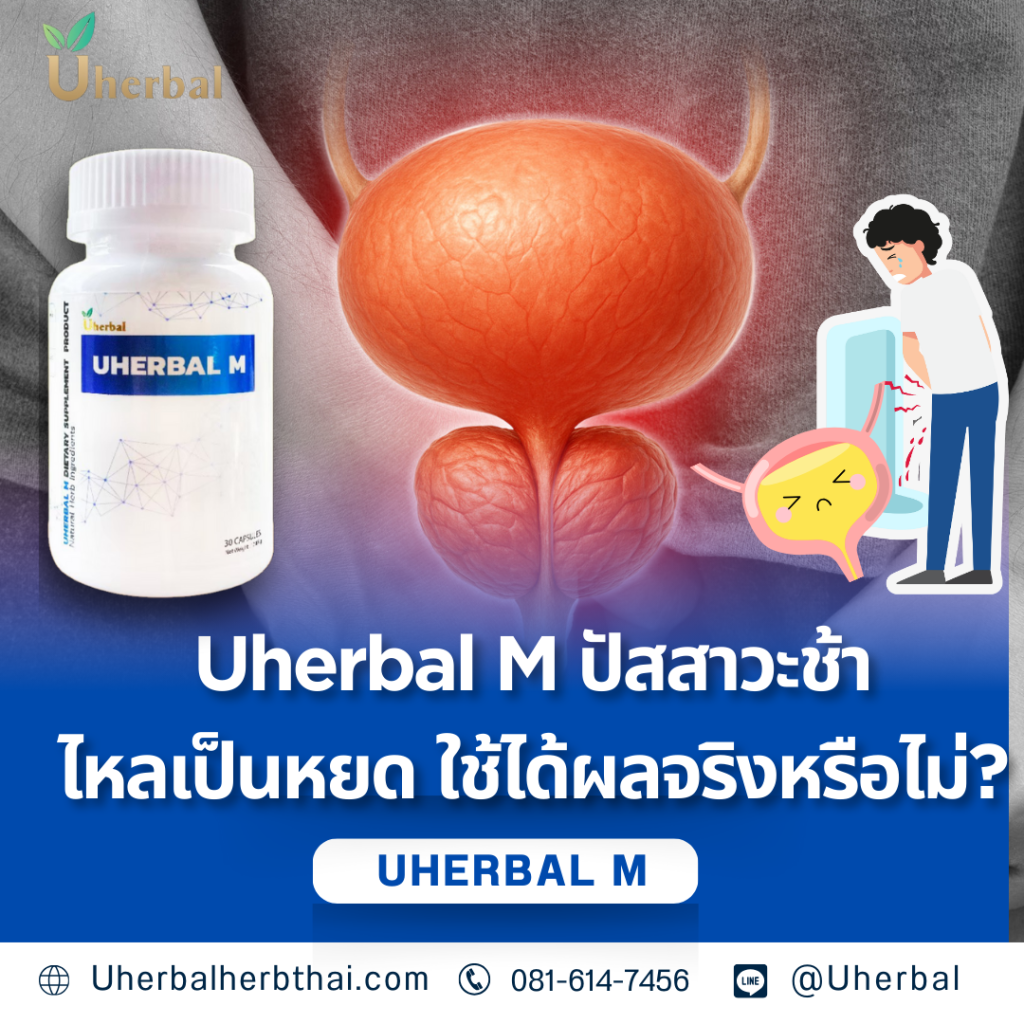 Uherbal M ปัสสาวะช้า ไหลเป็นหยด ใช้ได้ผลจริงหรือไม่?
