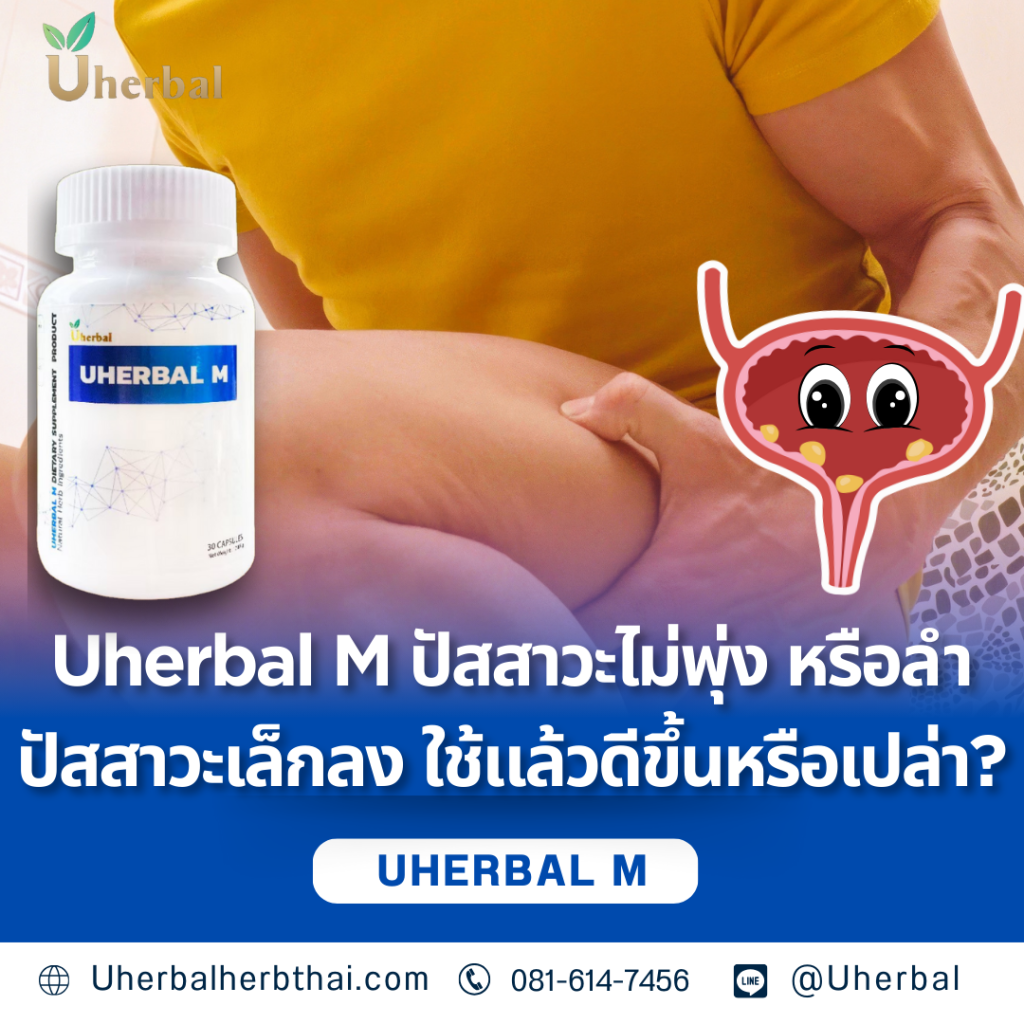 Uherbal M: ปัสสาวะไม่พุ่ง หรือลำปัสสาวะเล็กลง ใช้แล้วดีขึ้นหรือเปล่า?