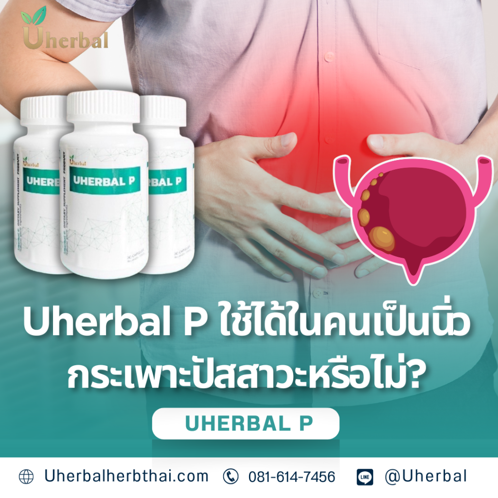 Uherbal P ใช้ได้ในคนเป็นนิ่วกระเพาะปัสสาวะหรือไม่?