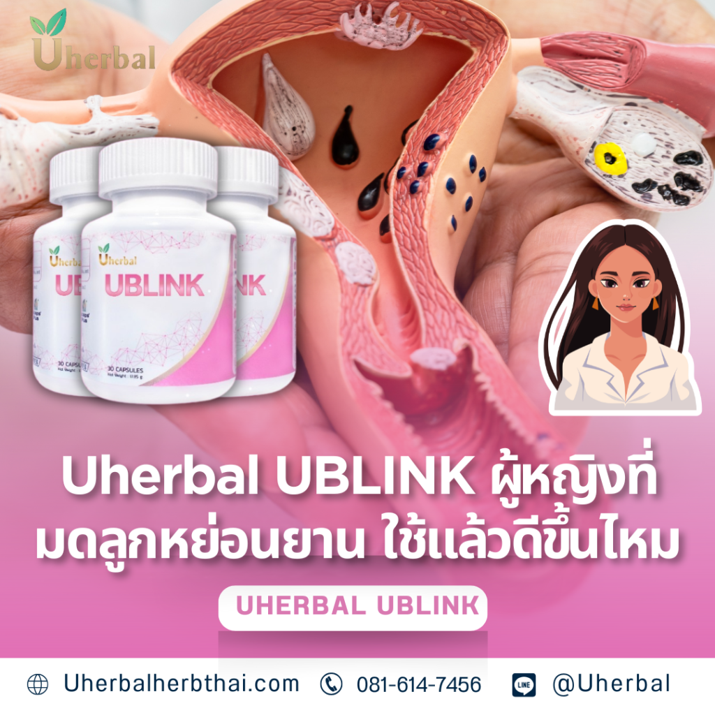Uherbal UBLINK: ผู้หญิงที่มดลูกหย่อนยาน ใช้แล้วดีขึ้นไหม? Uherbal N: ปวดเข่าบ่อย ใช้แล้วช่วยได้จริงไหม?  "อาการปวดเข่าบ่อยๆ" ไม่ว่าจะเป็นตอนเดิน ขึ้นบันได หรือแม้แต่นั่งพัก ก็สร้างความทรมานและจำกัดการใช้ชีวิต คำถามสำคัญคือผลิตภัณฑ์สมุนไพรอย่าง Uherbal N ใช้แล้วช่วยได้จริงไหม? คำตอบที่ชัดเจนคือ "ใช่, Uherbal N คือสูตรสมุนไพรที่ถูกพัฒนาขึ้นมาเพื่อ 'ดูแลและฟื้นฟูสุขภาพข้อเข่าและเส้นเอ็น' จากภายในโดยเฉพาะ" ซึ่งเป็นรากฐานสำคัญในการบรรเทาอาการปวดและคืนความคล่องตัว บทความนี้จะเจาะลึกถึงสาเหตุและกลไกการทำงานของ Uherbal N "ปวดเข่าบ่อย": สัญญาณเตือนจากข้อเข่าที่อ่อนล้า อาการปวดเข่าบ่อยๆ มักมีรากฐานมาจากหลายปัจจัยหลักที่เกี่ยวข้องกัน: การเสื่อมของกระดูกอ่อน (Cartilage Degeneration): เมื่อใช้งานข้อเข่ามาเป็นเวลานาน หรืออายุที่เพิ่มขึ้น กระดูกอ่อนที่ทำหน้าที่เป็นเบาะรองรับแรงกระแทกจะเริ่มเสื่อมสภาพ ทำให้กระดูกเสียดสีกัน เกิดอาการปวดและอักเสบ เส้นเอ็นและกล้ามเนื้อรอบเข่าอ่อนแอ: เส้นเอ็นและกล้ามเนื้อที่ทำหน้าที่พยุงข้อเข่า หากขาดการบำรุงหรือใช้งานหนักเกินไป จะเกิดการอักเสบ ตึง ยึด และไม่สามารถพยุงข้อเข่าได้อย่างเต็มที่ ทำให้เกิดอาการปวด การอักเสบสะสม: การอักเสบเรื้อรังภายในข้อเข่าจากสาเหตุต่างๆ เป็นตัวการสำคัญที่ทำให้เกิดอาการปวดตึงและจำกัดการเคลื่อนไหว การไหลเวียนโลหิตไม่ดี: การที่เลือดลมไปเลี้ยงบริเวณข้อเข่าได้ไม่เพียงพอ ทำให้เส้นเอ็นและข้อต่อขาดสารอาหารที่จำเป็นต่อการฟื้นฟู การดูแลที่ได้ผลในระยะยาว จึงต้องมุ่งเน้นที่การ "ลดการอักเสบ", "บำรุงเส้นเอ็นและข้อต่อ", และ "เพิ่มการไหลเวียนโลหิต" จากภายใน "ช่วยได้จริง" - Uherbal N เข้ามาช่วย "ฟื้นฟูข้อเข่า" ได้อย่างไร? Uherbal N คือสูตรสมุนไพรที่เข้าใจกลไกเหล่านี้อย่างลึกซึ้ง จึงเข้าไปดูแลที่ต้นตอของปัญหาโดยตรง: กลไกที่ 1: "ลดการอักเสบ" (Reduces Inflammation) ต้นตอของความปวด ทำงานอย่างไร: Uherbal N มีส่วนประกอบสำคัญอย่าง เถาวัลย์เปรียง (Jewel Vine) ซึ่งได้รับการยอมรับในศาสตร์สมุนไพรไทยว่ามีคุณสมบัติโดดเด่นในการ "ลดการอักเสบ" ของกล้ามเนื้อและเส้นเอ็น ช่วยบรรเทาอาการปวดเข่าที่เกิดจากการอักเสบได้อย่างตรงจุด กลไกที่ 2: "บำรุงเส้นเอ็นและข้อต่อ" (Nourishes Tendons & Joints) เพื่อความแข็งแรง ทำงานอย่างไร: ด้วยส่วนผสมของสมุนไพรบำรุงอย่าง โสม (Ginseng) และ กระชายดำ (Black Galingale) ที่ช่วยส่งเสริมการไหลเวียนโลหิต ทำให้เลือดนำพาสารอาหารที่จำเป็นไปหล่อเลี้ยงและฟื้นฟูเส้นเอ็นและเนื้อเยื่อรอบข้อเข่า ช่วยให้เส้นเอ็นมีความยืดหยุ่นและแข็งแรงขึ้น ทำให้ข้อเข่าทำงานได้ดีขึ้น กลไกที่ 3: "ฟื้นฟูความยืดหยุ่น" (Restores Flexibility) คืนความคล่องตัว ทำงานอย่างไร: การทำงานร่วมกันของสมุนไพรใน Uherbal N จะช่วยให้เส้นเอ็นและข้อต่อกลับมามีความยืดหยุ่นที่ดีขึ้น ลดอาการตึง ยึด และขัด ทำให้การเคลื่อนไหวของข้อเข่าเป็นไปอย่างราบรื่นและคล่องตัวมากขึ้น ใครที่ควรใช้ Uherbal N? ✅ ผู้ที่มีอาการ #ปวดเข่าบ่อย #ปวดเข่าเรื้อรัง ✅ ผู้ที่รู้สึกว่า #ข้อเข่าฝืด #เข่าตึง หรือ #เข่าขัด ✅ ผู้ที่มีปัญหา #เส้นเอ็นอักเสบ หรือ #เส้นเอ็นรอบเข่าตึง ✅ ผู้ที่ต้องการ #บำรุงข้อเข่า และเสริมความแข็งแรงให้ระบบการเคลื่อนไหว คำถามที่พบบ่อย (FAQ) Q: ต้องทาน Uherbal N นานแค่ไหน อาการปวดเข่าถึงจะดีขึ้น? A: การฟื้นฟูข้อเข่าและเส้นเอ็นต้องใช้เวลาและความสม่ำเสมอ โดยทั่วไปจะเริ่มรู้สึกถึงการเปลี่ยนแปลงที่ดีขึ้นในเรื่องอาการปวดและความคล่องตัวภายใน 2-4 สัปดาห์แรก และจะเห็นผลลัพธ์ที่ชัดเจนเมื่อทานต่อเนื่อง 1-3 เดือน Q: Uherbal N แตกต่างจากยาแก้ปวดทั่วไปอย่างไร? A: ยาแก้ปวดมักทำงานที่ปลายเหตุเพื่อระงับอาการปวดชั่วคราว แต่ Uherbal N เป็นสมุนไพรที่เน้นการ "บำรุง" และ "ฟื้นฟู" ที่ต้นตอของปัญหา ช่วยลดการอักเสบและเสริมสร้างความแข็งแรงอย่างยั่งยืน สรุป Uherbal N "ช่วยได้จริง" สำหรับผู้ที่มีอาการปวดเข่าบ่อยอย่างแน่นอน เพราะเป็นการดูแลที่ "ต้นตอ" ของปัญหา ทั้งการลดการอักเสบ, บำรุงเส้นเอ็นและข้อต่อ, และฟื้นฟูความยืดหยุ่น Uherbal N จึงเป็นทางเลือกจากธรรมชาติที่ทรงประสิทธิภาพในการคืนความแข็งแรง, ความคล่องตัว, และคุณภาพชีวิตที่ดีให้ข้อเข่าของคุณ ช่องทางแนะนำผลิตภัณฑ์ Uherbal 🌿 เพื่อข้อเข่าที่แข็งแรง... พร้อมทุกการเคลื่อนไหว... ไม่ต้องทนปวดอีกต่อไป 📞 โทร: 081-614-7456 💬 LINE ID: @uherbal 🌐 คลิกแอดไลน์:https://line.me/ti/p/~@uherbal 💻 เว็บไซต์: www.uherbalherbthai.com #UherbalN #ปวดเข่า #ปวดเข่าเรื้อรัง #ข้อเข่าเสื่อม #บำรุงข้อเข่า #สมุนไพรแก้ปวดเข่า #เถาวัลย์เปรียง #โสม #ฟื้นฟูข้อต่อ