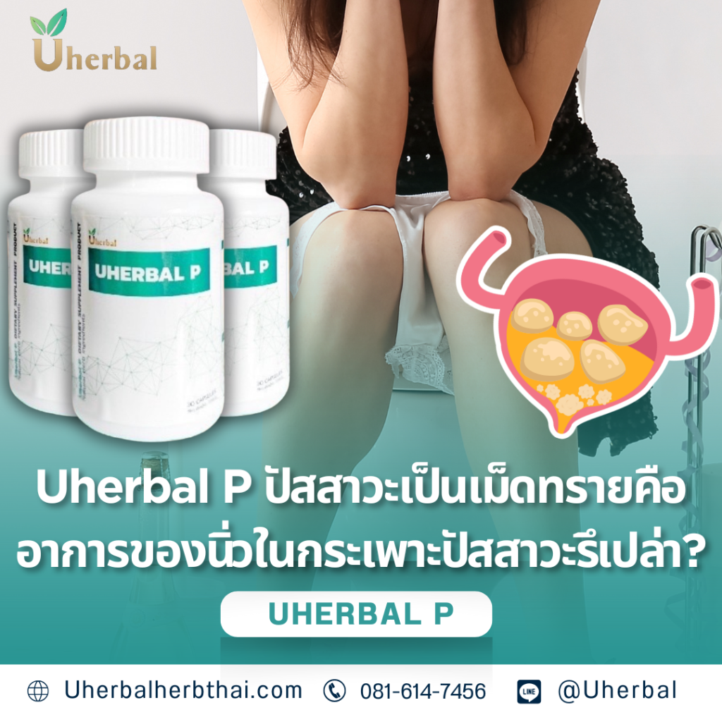 Uherbal P: ปัสสาวะเป็นเม็ดทราย คืออาการของนิ่วในกระเพาะปัสสาวะรึเปล่า? 