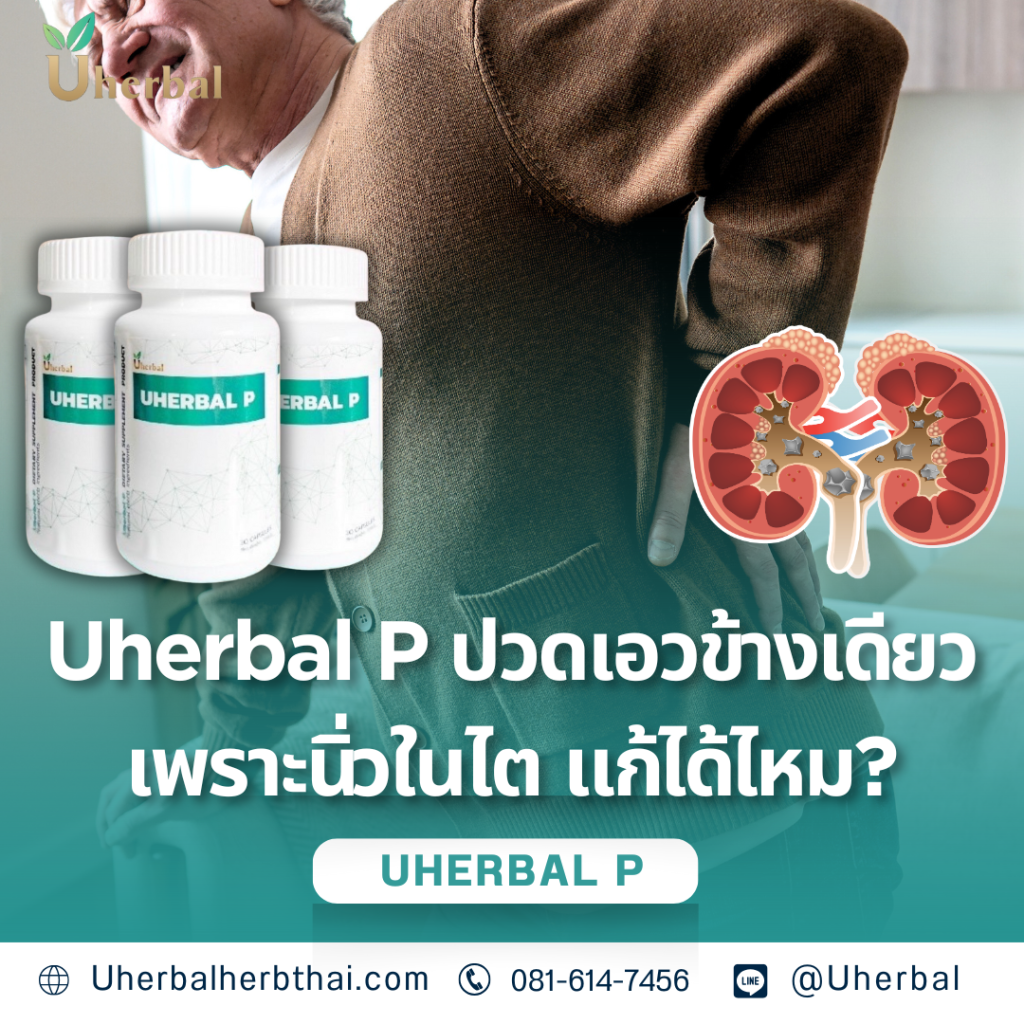 Uherbal P ปวดเอวข้างเดียวเพราะนิ่วในไต แก้ได้ไหม?