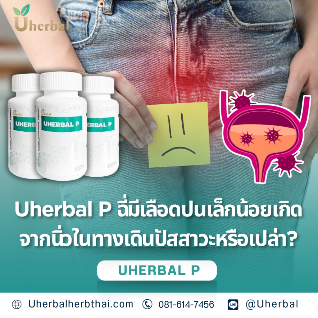 Uherbal P ฉี่มีเลือดปนเล็กน้อย เกิดจากนิ่วในทางเดินปัสสาวะหรือเปล่า? 