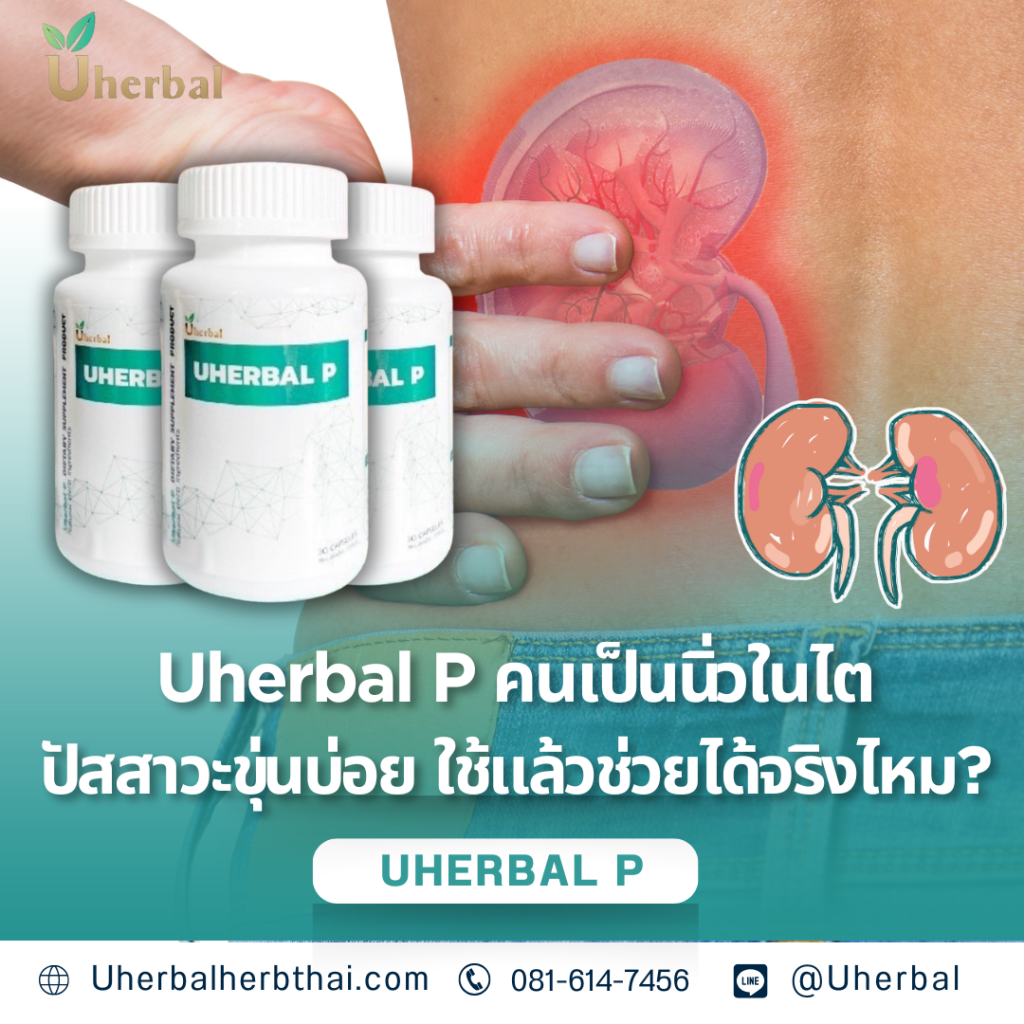 Uherbal P คนเป็นนิ่วในไต ปัสสาวะขุ่นบ่อย ใช้แล้วช่วยได้จริงไหม? 