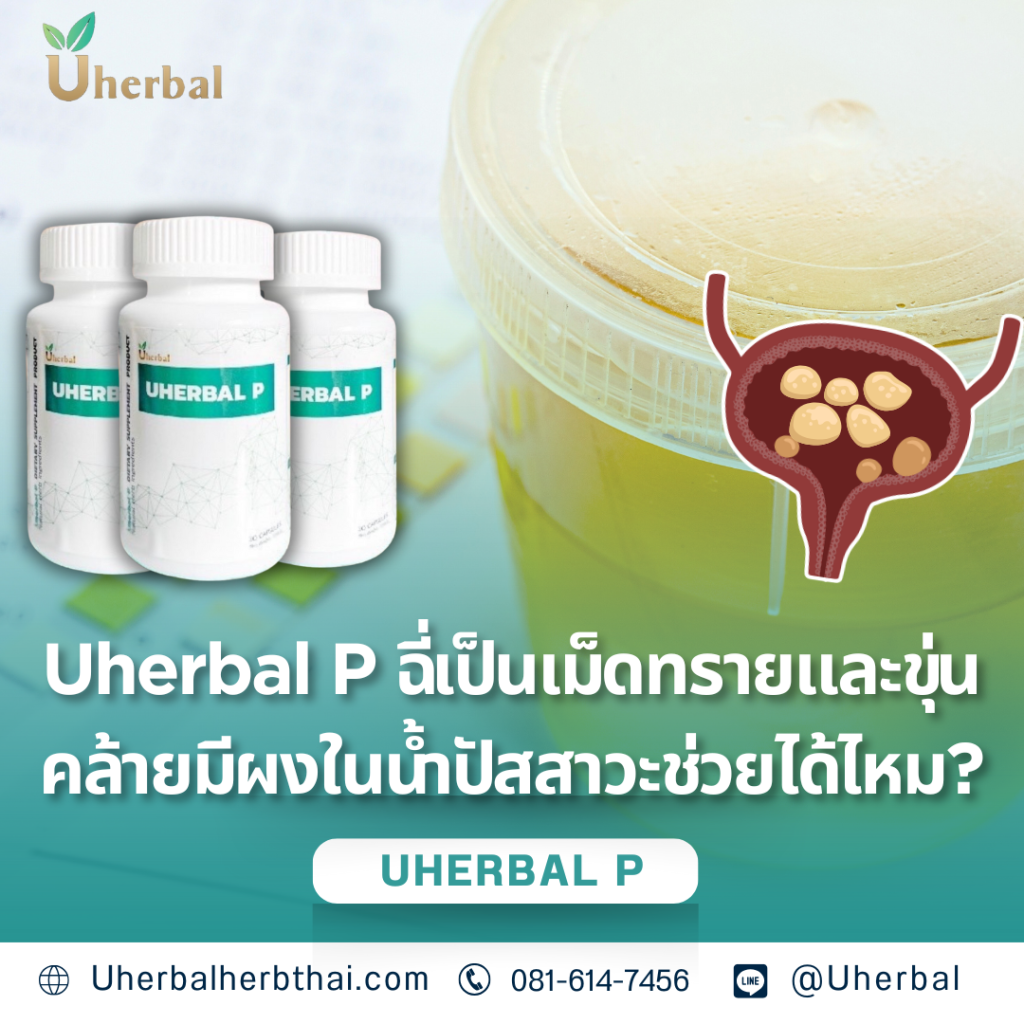 Uherbal P ฉี่เป็นเม็ดทรายและขุ่นคล้ายมีผงในน้ำปัสสาวะช่วยได้ไหม?
