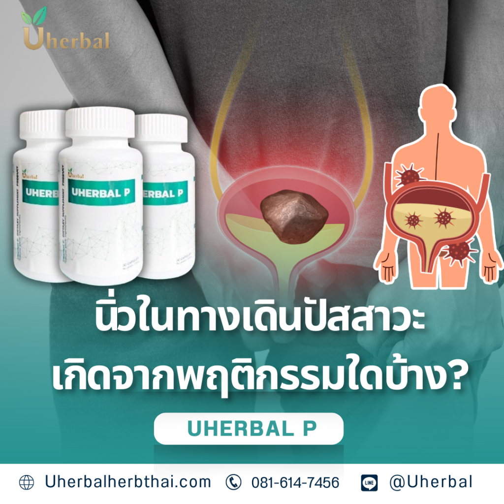 "นิ่วในทางเดินปัสสาวะ" เกิดจากพฤติกรรมใดบ้าง?