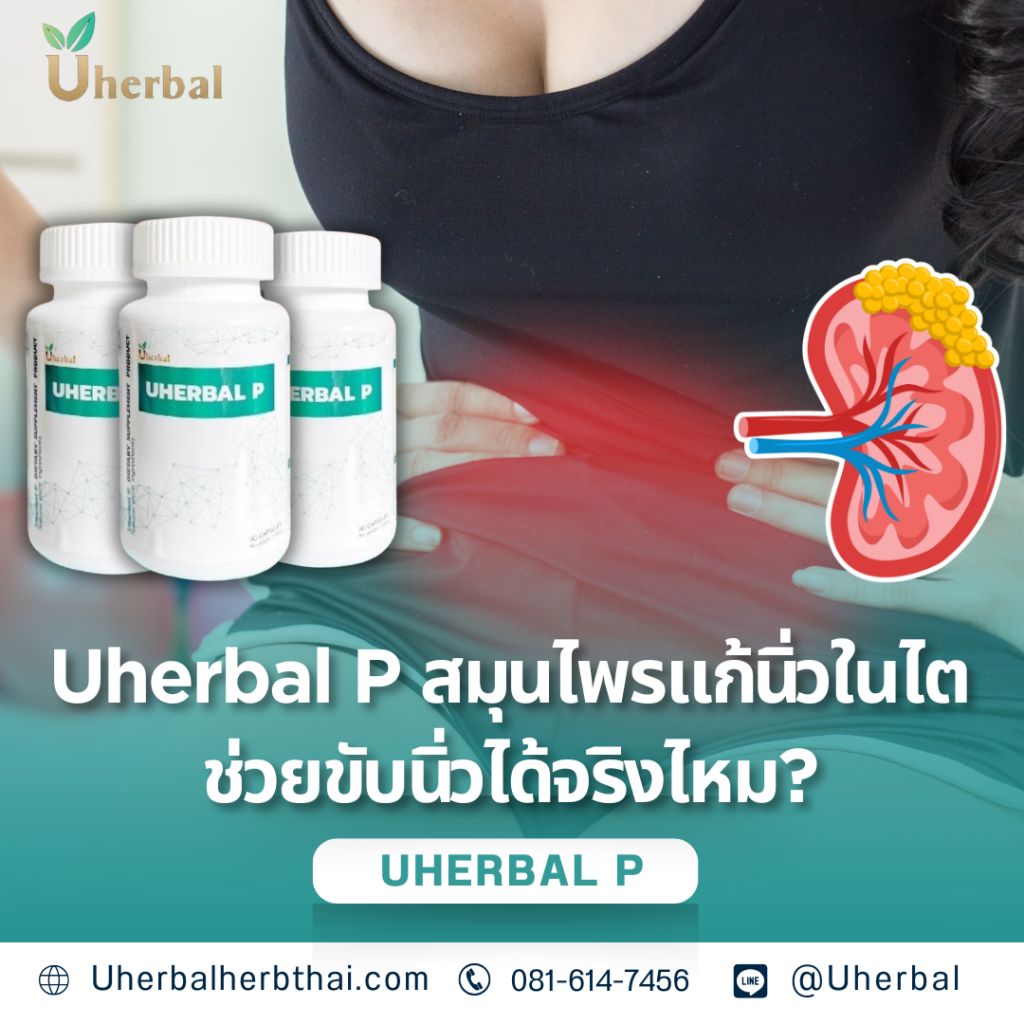 Uherbal P สมุนไพรแก้นิ่วในไต ช่วยขับนิ่วได้จริงไหม?