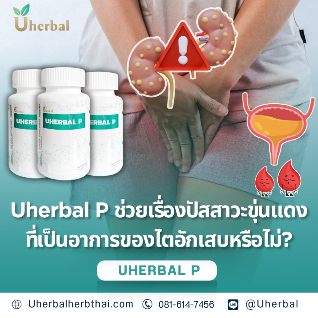 Uherbal P ช่วยเรื่องปัสสาวะขุ่นแดงที่เป็นอาการของไตอักเสบหรือไม่?