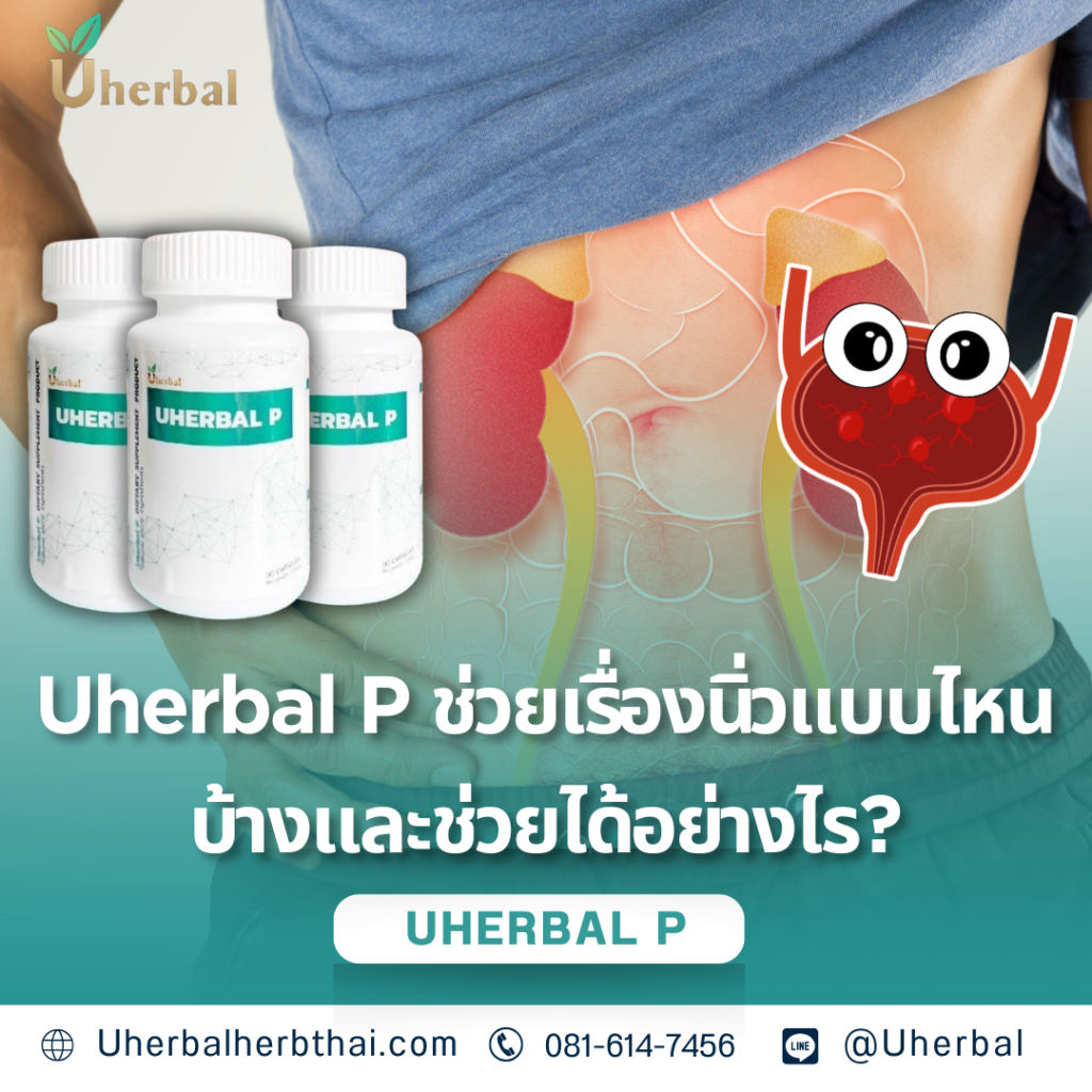 Uherbal P ช่วยเรื่องนิ่วแบบไหนบ้างและช่วยได้อย่างไร?